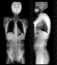 The EOS System with Clinical Case Studies Not Found