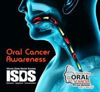 Oral Cancer Image Not Found
