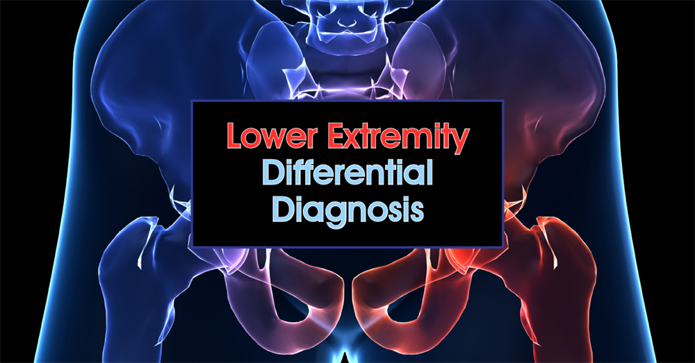 Lower Extremity Differential Diagnosis Maximize evaluation efficiency