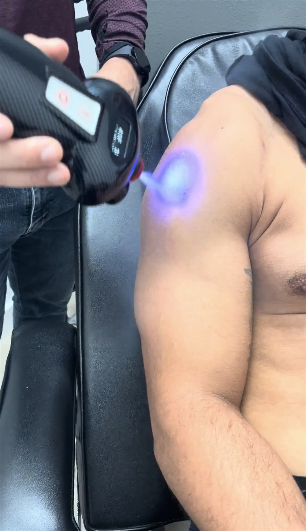 Local Cryotherapy Machine